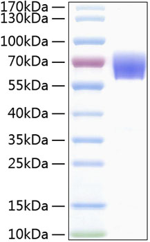Recombinant human trem-1 protein 50 µg