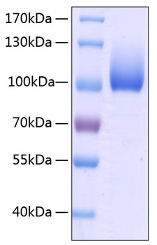 Recombinant human limpii/sr-b2 prot ein 500 µg