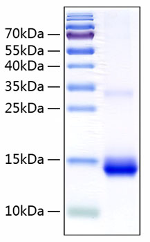 Recombinant human cystatin sn/cst1 protein (cst1, cystain-sa-i, cystatin 1, cystatin sa-i, cystatin 50 µg