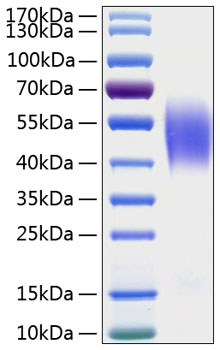 Recombinant human ceacam6 protein 20 µg