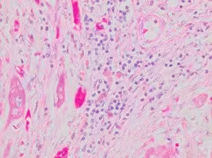 Hematoxylin Solution, Gill No. 2, 4 l