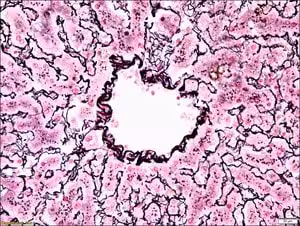 Reticulum stain kit 1 kit