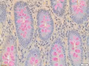 Weigert s iron hematoxylin solution set 1set 1 SET