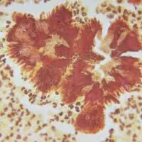 Brown-brenn 100 tests