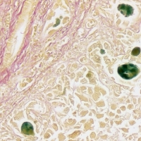 Fouchet van gieson 100 tests