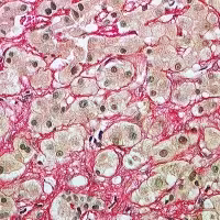 Picrate rouge sirius 100 tests