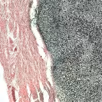 Von kossa 100 tests