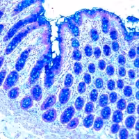 Fer colloïdal 100 tests