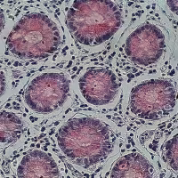 Mucicarmine 100 tests