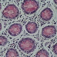 Mucicarmine 100 tests