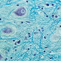 Bleu rapide de luxol kluwer barrera 100 tests