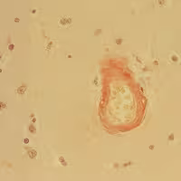 Rouge congo 100 tests