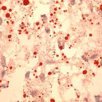 Oil red o 100 tests