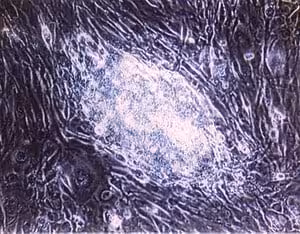 Esg2206 - rat esgro 1 million units 1 MU