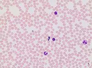 May-grunwald stain 0.25% w/v in 500 ml