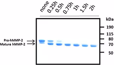 Recombinant Human MMP-2 (carrier-free) 10 µg