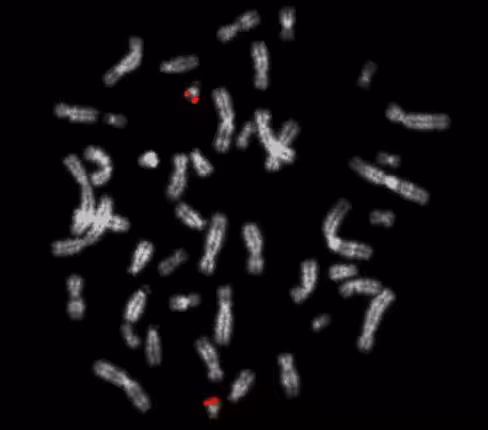 Sonde XA 21q22 orange 100 µl 10 tests