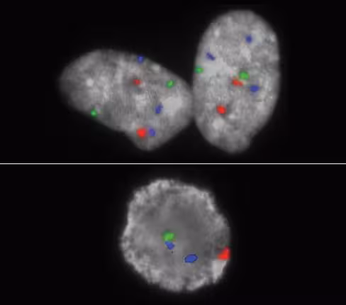 Sonde XA AneuScore III (XA 13/18/21 + XA X/Y/18) orange/green/blue 2x 100 µl