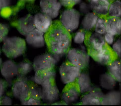 Sonde XL ALK BA orange/green 100 µl 10 tests
