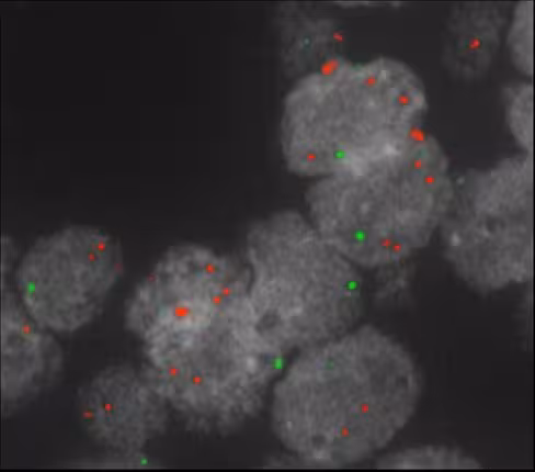 Sonde XL MYC amp orange/green 100 µl 10 tests