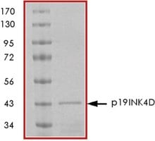 P19ink4d gst tagged human 50 µg