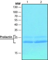 Prolactin human recombinant expressed 50 µg