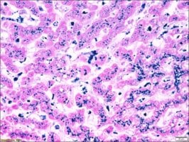 Iron TISSUE-TROL Control Slides, 25 pièces