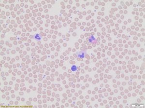 Wright-giemsa stain modified (manual) 500 ml