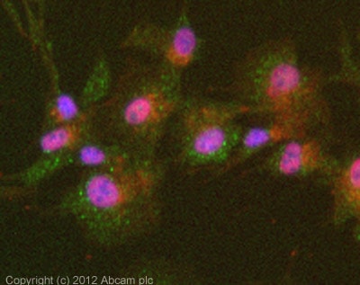 Kit de Dosage Activité Trypsine (Colorimétrique) 100 Tests