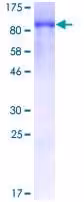 Kit de Coloration des Lysosomes - Fluorescence Rouge - Cytopainter 500 Tests