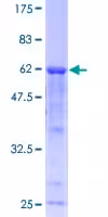 Protéine Recombinante Humain Superoxide Dismutase 1 (Active) 100 µg