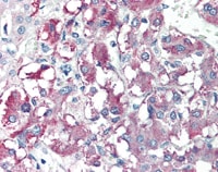 Kit d'Extraction des Histones 100 Tests