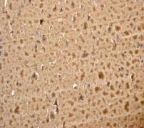 Marqueur de poids moléculaires protéiques précoloré - Poids moléculaire large (10 - 245 kDa) 500 µl