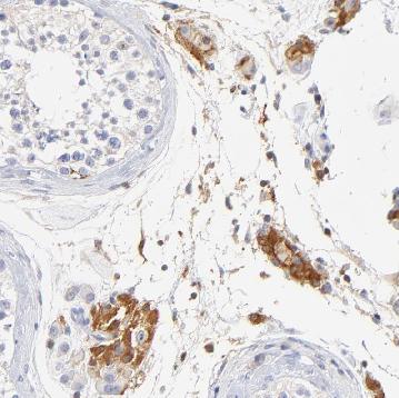 Inhibiteur (V)-ATPase, Bafilomycine A1 10 µg