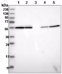 Inihibteur des Microtubules, Nocodazole 25 mg