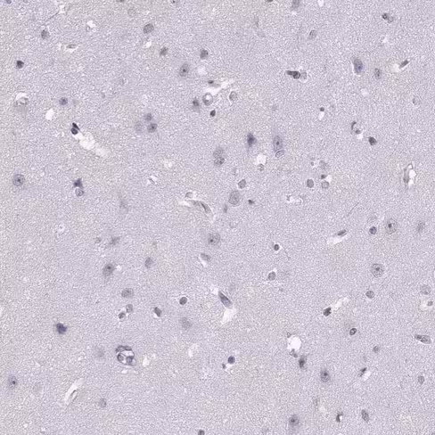 Antagoniste du CXCR4, Octachlorhydrate AMD3100 10 mg