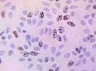 Immunohistochimie BrdU 1 Kit