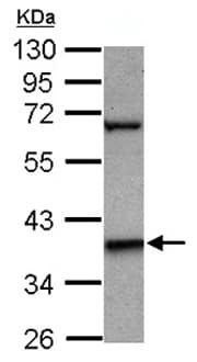 Protéine recombinante humain PDHA1 50 µg