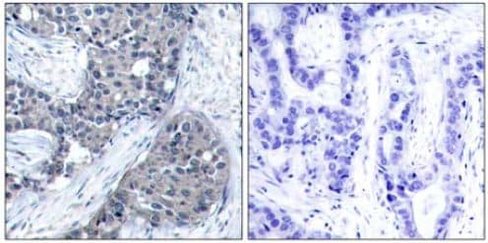 Kit de Purification d'Anticorps (Protéine G) 1 Test