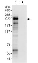Kit de dépistage des inhibiteurs de la dipeptidyl peptidase IV (DPP4) 96 Tests