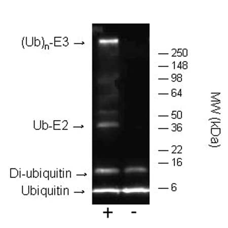 Kit ELISA Aldosterone 96 Tests