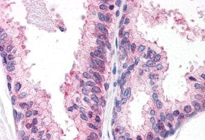 Inhibiteur de Methyltransferase EZH2, UNC1999 25 mg