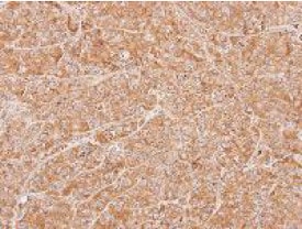 Inhibiteur de sérine protéase, Aprotinine 50 mg