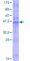 Kit de Coloration Periodic Acid Schiff (PAS) (Colorant Mucine) 100 Tests