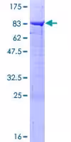Kit de Dosage Activité Creatine Kinase (Colorimétrique) 100 Tests