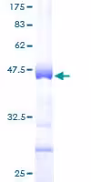 Tampon de lyse natif 15 ml