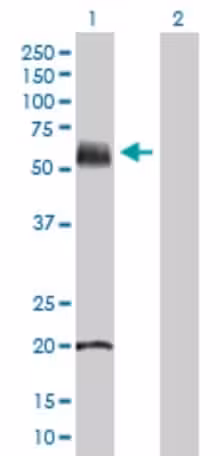 Protéine recombinante humain NLRP3 2 µg