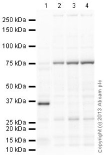 Antibody Array Humain Chémokines - Membrane (38 cibles) 1 x 4 membranes