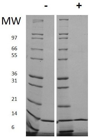 Kit ELISA 8 Isoprostane 96 Tests