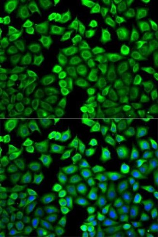 Protéine G Sepharose 1 ml